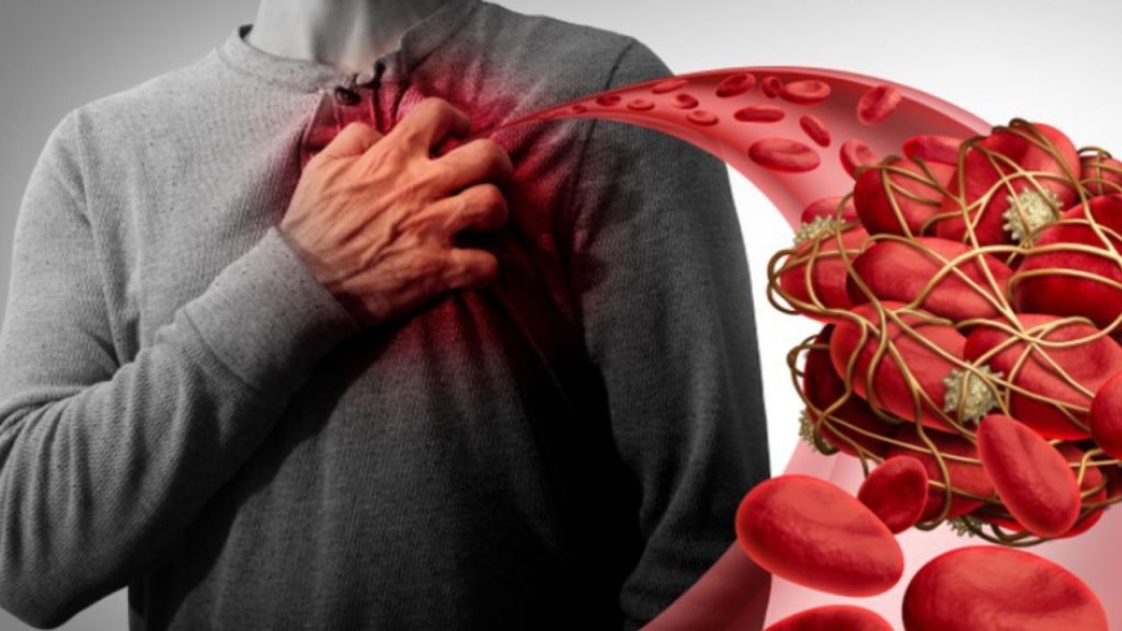 Causes Blood Clots: किस विटामिन की कमी से बनते है खून के थक्के?  सेहत के लिए फायदेमंद साबित होगा ये Vitamin