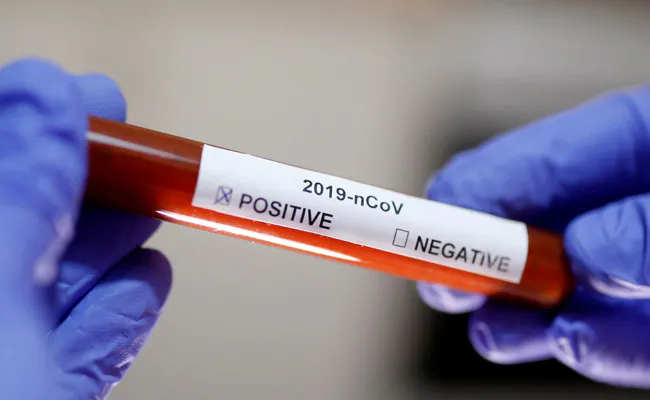 Corona Virus: सावधान! कोरोना फिर आ गया…भारत में 2710 हुए कोविड के एक्टिव मामले