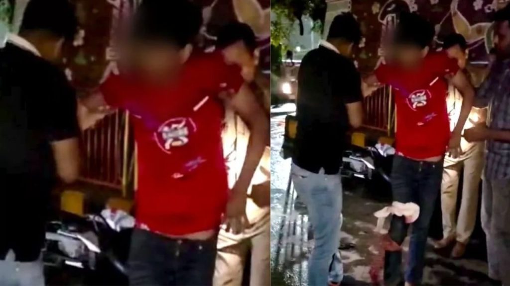 Uttar-Pradesh: बदमाशों पर कहर बनकर टूटी CM योगी की पुलिस…एक के पैर में लगी गोली